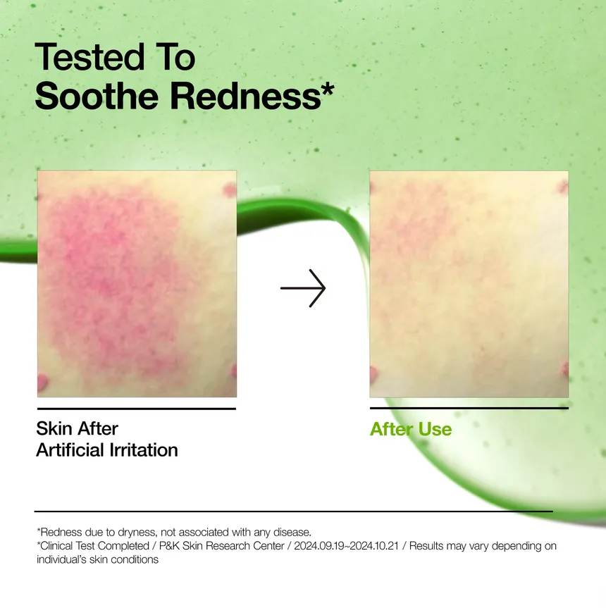 Anua Azelaic Acid 10 Hyaluron Redness Soothing Serum - My Korean Beauty