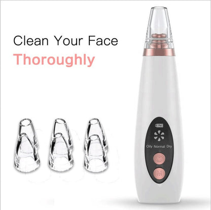 Aspirateur Points Noirs 5 Têtes Effet Peeling - My Korean Beauty 