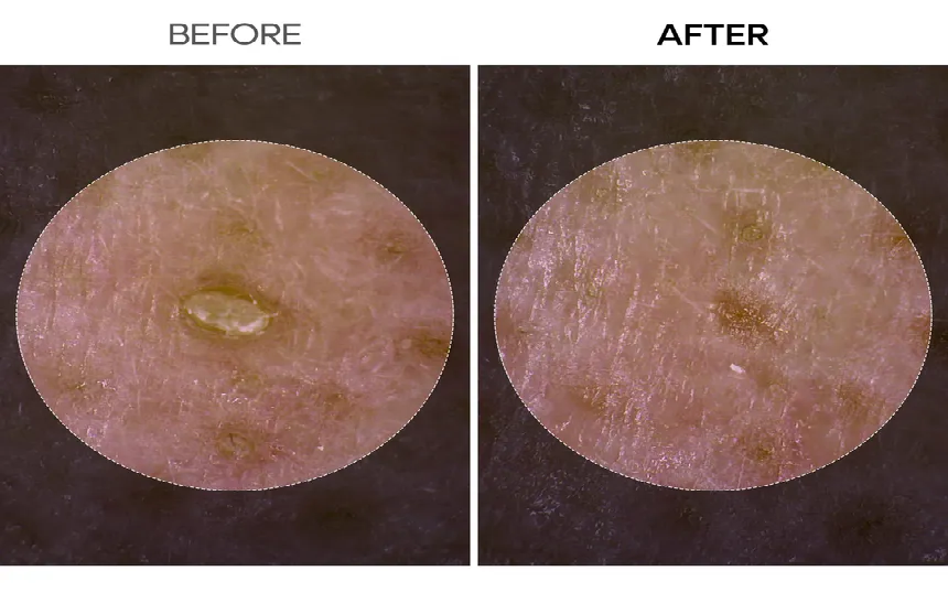Dr.Melaxin Peel Shot Exfoliant Rice Ampoule - My Korean Beauty 