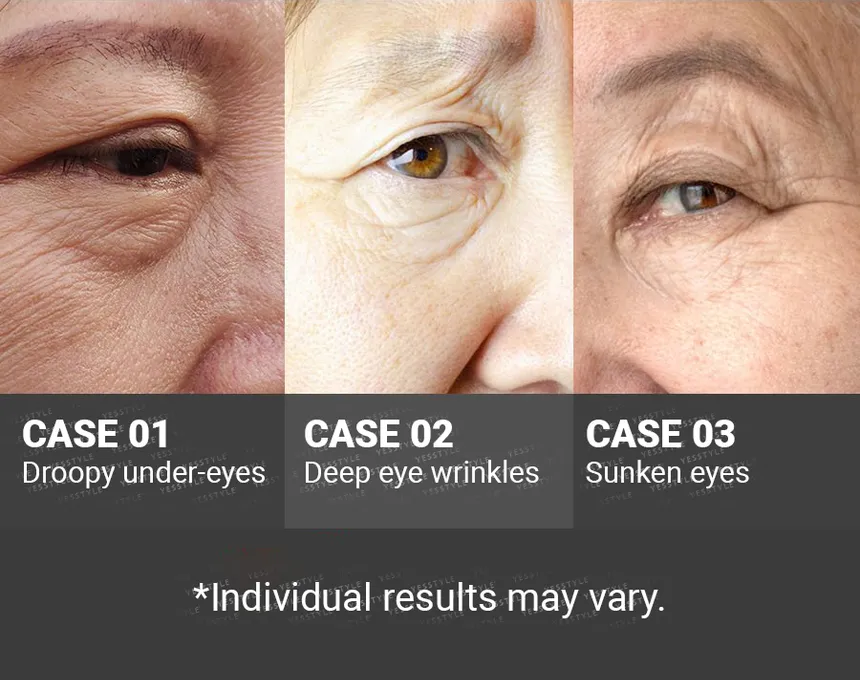 MEDIPEEL Peptide 9 Volume Lift-Eye Cream - My Korean Beauty