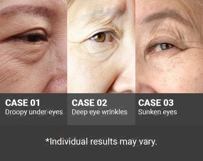MEDIPEEL Peptide 9 Volume Lift-Eye Cream - My Korean Beauty