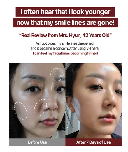 mommy care - EMS V-THERA Pink Edition - My Korean Beauty 